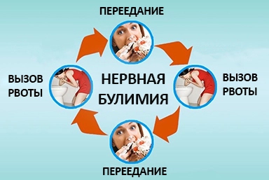 Лечение булимии во Владивостоке